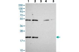 Western blot analysis of Lane 1: RT-4, Lane 2: U-251 MG, Lane 3: Human Plasma, Lane 4: Liver, Lane 5: Tonsil with KIAA1143 polyclonal antibody  at 1:250-1:500 dilution. (KIAA1143 抗体)