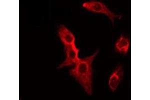 ABIN6275515 staining HeLa by IF/ICC. (SFRP2 抗体  (Internal Region))