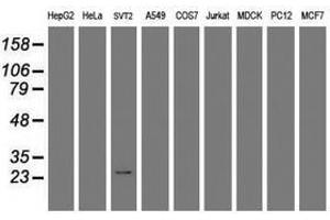 Image no. 1 for anti-Regulator of G-Protein Signaling 16 (RGS16) antibody (ABIN1500688) (RGS16 抗体)