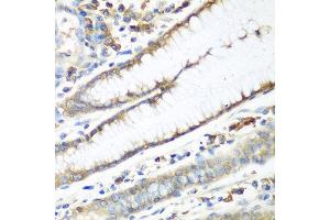 Immunohistochemistry of paraffin-embedded human stomach using CAD antibody at dilution of 1:100 (40x lens). (CAD 抗体)