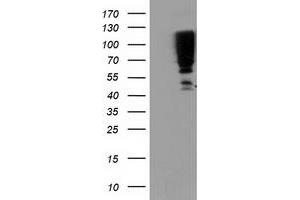 Western Blotting (WB) image for anti-serpin Peptidase Inhibitor, Clade B (Ovalbumin), Member 13 (SERPINB13) antibody (ABIN1500880) (SERPINB13 抗体)