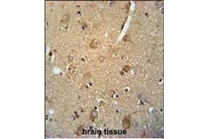 Immunohistochemistry (Paraffin-embedded Sections) (IHC (p)) image for anti-CCZ1 Vacuolar Protein Trafficking and Biogenesis Associated Homolog (S. Cerevisiae) (CCZ1) (AA 239-265) antibody (ABIN651645)