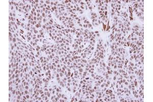 IHC-P Image Immunohistochemical analysis of paraffin-embedded KYSE170 xenograft, using RCC1, antibody at 1:500 dilution. (RCC1 抗体)