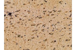 IRS1 Mouse Monoclonal Antibody at 1/100 staining mouse brain tissue by IHC-P.