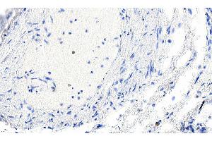 Smooth Muscle Actin 抗体  (N-Term)