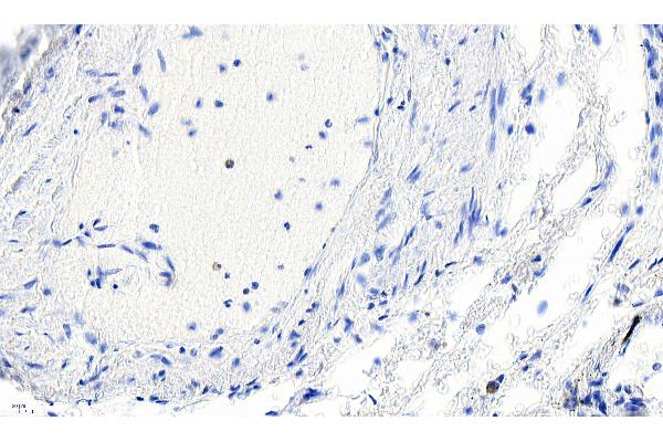 Smooth Muscle Actin 抗体  (N-Term)