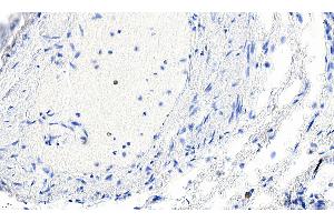 ABIN185271 Negative Control showing staining of paraffin embedded Human Lung, with no primary antibody. (Smooth Muscle Actin 抗体  (N-Term))