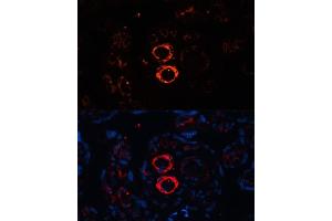 Immunofluorescence analysis of human placenta cells using SMMHC/SMMHC/MYH11 antibody (ABIN6129611, ABIN6144234, ABIN6144235 and ABIN6215005) at dilution of 1:100. (MYH11 抗体  (AA 1680-1979))