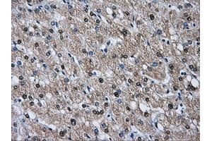 Immunohistochemical staining of paraffin-embedded liver tissue using anti-HSPA1Amouse monoclonal antibody. (HSP70 1A 抗体)