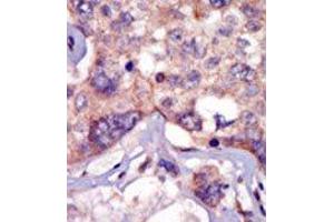 Image no. 2 for anti-Lymphocyte-Specific Protein tyrosine Kinase (LCK) (N-Term) antibody (ABIN359986) (LCK 抗体  (N-Term))