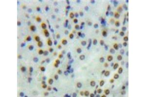 Used in DAB staining on fromalin fixed paraffin-embedded Kidney tissue (PYGO1 抗体  (AA 201-419))