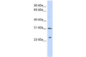 WB Suggested Anti-SSX5 Antibody Titration:  0. (SSX5 抗体  (Middle Region))