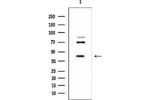 Western blot analysis of lysates from EC304 cells, using HFE2 Mouse Monoclonal Antibody at 1/1000 dilution.