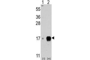 Western Blotting (WB) image for anti-Fagilis antibody (ABIN2996245) (Fagilis 抗体)