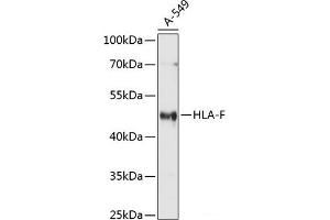 Western blot analysis of extracts of A-549 cells using HLA-F Polyclonal Antibody at dilution of 1:1000. (HLA-F 抗体)