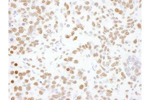 Immunohistochemistry (IHC) image for anti-Heterogeneous Nuclear Ribonucleoprotein L (HNRNPL) (AA 350-400) antibody (ABIN7795591) (HNRNPL 抗体  (AA 350-400))