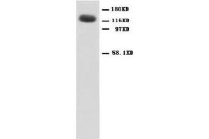 NMDAR1 Polyclonal Antibody (NMDA 1 Receptor 抗体  (N-Term))