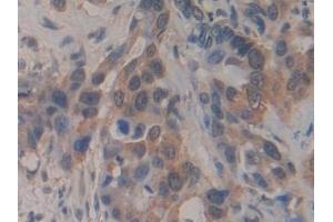 Immunohistochemistry (IHC) image for anti-Breast Carcinoma Amplified Sequence 3 (BCAS3) (AA 230-546) antibody (ABIN7443374)