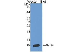 Detection of Recombinant SCCA2, Human using Monoclonal Antibody to Serpin Peptidase Inhibitor,Clade B,Member 4 (SERPINB4) (SERPINB4 抗体  (AA 144-298))