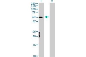 Western Blot analysis of MEF2D expression in transfected 293T cell line by MEF2D MaxPab polyclonal antibody. (MEF2D 抗体  (AA 1-521))