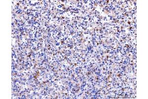 IHC analysis of Acid Phosphatase/ACP5 using anti-Acid Phosphatase/ACP5 antibody (ABIN7601574).