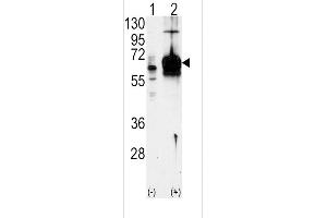 Western blot analysis of GUCY1A3 using GUCY1A3 Antibody using 293 cell lysates (2 ug/lane) either nontransfected (Lane 1) or transiently transfected with the GUCY1A3 gene (Lane 2). (GUCY1A1 抗体  (N-Term))