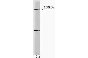 Western blot analysis of Nestin on a rat (E17) cerebrum lysate. (Nestin 抗体  (AA 402-604))