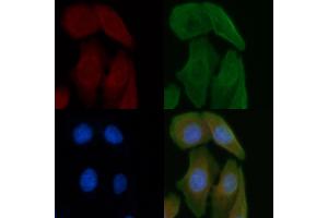 ABIN6261307 and ABIN6277247 staining Hela cells by IF/ICC. (DKK3 抗体)