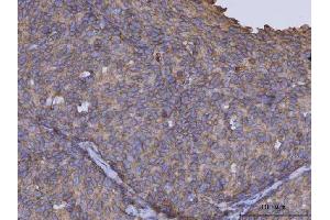 IHC analysis of ARL1 using anti-ARL1 antibody (ABIN7602848).