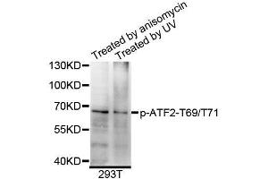 Western blot analysis of extracts of 293T cells, using Phospho-ATF2-T69/T71 antibody (ABIN5995600) at 1/1000 dilution. (ATF2 抗体  (pThr69, pThr71))