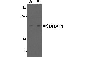 Western blot analysis of SDHAF1 in 3T3 cell lysate with SDHAF1 antibody at (A) 1 and (B) 2 µg/mL. (SDHAF1 抗体  (C-Term))