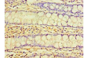 Immunohistochemistry of paraffin-embedded human colon tissue using ABIN7173568 at dilution of 1:100 (TNNC2 抗体  (AA 1-160))