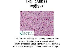 Image no. 1 for anti-Caspase Recruitment Domain Family, Member 11 (CARD11) (AA 18-238) antibody (ABIN1732634) (CARD11 抗体  (AA 18-238))