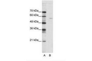 Image no. 1 for anti-ELK1, Member of ETS Oncogene Family (ELK1) (N-Term) antibody (ABIN202499) (ELK1 抗体  (N-Term))