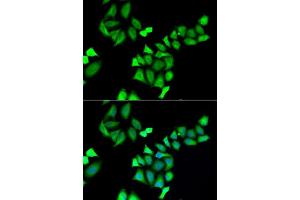 Immunofluorescence analysis of A549 cells using GALE antibody. (GALE 抗体  (AA 129-348))