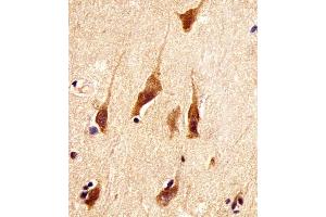 (ABIN6242191 and ABIN6578387) staining ARRB2 in human brain tissue sections by Immunohistochemistry (IHC-P - paraformaldehyde-fixed, paraffin-embedded sections). (Arrestin 3 抗体  (AA 264-298))