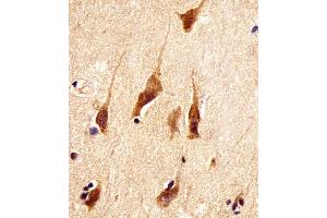 (ABIN6242191 and ABIN6578387) staining ARRB2 in human brain tissue sections by Immunohistochemistry (IHC-P - paraformaldehyde-fixed, paraffin-embedded sections).