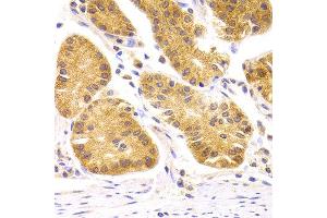 Immunohistochemistry of paraffin-embedded Human gastric using SCO2 antibody at dilution of 1:100 (x400 lens). (SCO2 抗体)