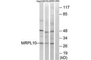 Western blot analysis of extracts from 293/HepG2/COLO cells, using MRPL10 Antibody. (MRPL10 抗体  (AA 211-260))