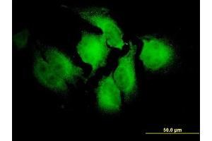 Immunofluorescence of monoclonal antibody to NOTCH2NL on HeLa cell. (NOTCH2NL 抗体  (AA 1-236))