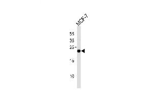 Lane 1: MCF-7 Cell lysates, probed with MGMT (888CT22. (MGMT 抗体)