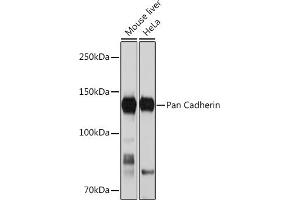Western blot analysis of extracts of various cell lines, using Pan Cadherin Rabbit mAb (ABIN1679719, ABIN3019268, ABIN3019269 and ABIN7101741) at 1:1000 dilution. (CDH1,CDH2,CDH3,CDH4 抗体)