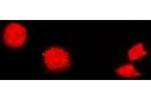 Immunofluorescent analysis of Cholinesterase staining in U2OS cells. (Butyrylcholinesterase 抗体)