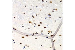 Immunohistochemistry of paraffin-embedded rat brain using MT2A antibody (ABIN1873764) at dilution of 1:200 (40x lens). (MT2A 抗体)