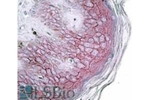 AP31715PU-N DSG1 antibody staining of paraffin embedded Human skin at 3. (Desmoglein 1 抗体  (Internal Region))
