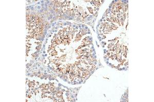 Immunohistochemistry (IHC) image for anti-Kelch-Like 9 (KLHL9) (AA 1-100) antibody (ABIN6142940)