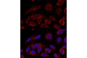Confocal immunofluorescence analysis of U2OS cells using [KO Validated] HADHA Polyclonal Antibody (ABIN6131742, ABIN6141586, ABIN6141588 and ABIN7101770) at dilution of 1:100. (HADHA 抗体  (AA 484-763))
