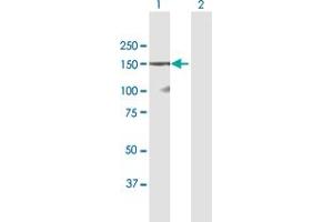 Western Blot analysis of DSG1 expression in transfected 293T cell line by DSG1 MaxPab polyclonal antibody. (Desmoglein 1 抗体  (AA 1-1049))