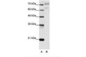 Image no. 1 for anti-Apoptosis Antagonizing Transcription Factor (AATF) (N-Term) antibody (ABIN202765) (AATF 抗体  (N-Term))