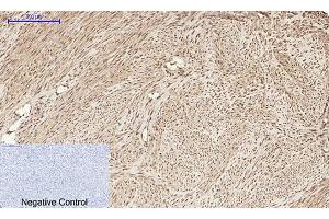 Immunohistochemical analysis of paraffin-embedded human uterus tissue. (HMGB1 抗体  (N-Term))